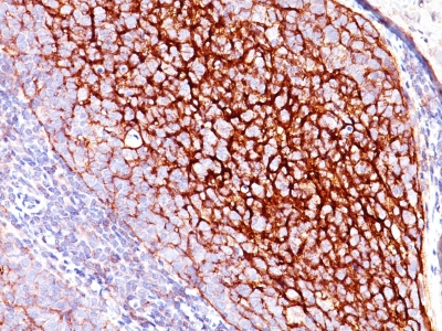 Formalin-fixed, paraffin-embedded human Tonsil stained with CD35 Ab (E11).