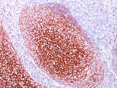 Formalin-fixed, paraffin-embedded human Tonsil stained with CD35 Monoclonal Antibody (CR1/82).