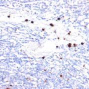 Formalin-fixed, paraffin-embedded human Tonsil stained with G-CSF Monoclonal Antibody (CSF3/9). Note specific cytoplasmic staining of granulocytes.