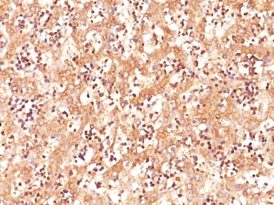 Formalin-fixed, paraffin-embedded human Fetal Liver stained with Anti-AFP Monoclonal Antibody (C3). Epitope retrieval (HIER) was performed using citrate buffer pH 6.0. Primary antibody was diluted 1:200 for staining.