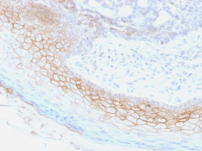 Formalin-fixed, paraffin-embedded human Skin stained with Desmocollin-2/3 Monoclonal Antibody (7G6).