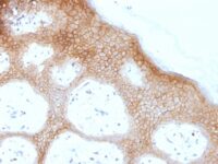 Formalin-fixed, paraffin-embedded human Skin stained with Desmoglein-1 Monoclonal Antibody (DSG1/1733).