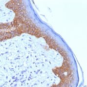 Formalin-fixed, paraffin-embedded human Skin stained with Desmoglein-3 Monoclonal Antibody (5G11).