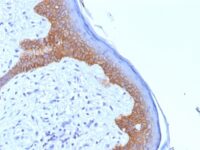 Formalin-fixed, paraffin-embedded human Skin stained with Desmoglein-3 Monoclonal Antibody (5G11).