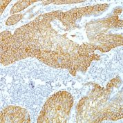 Formalin-fixed, paraffin-embedded Human Skin stained with Desmoglein-3 Monoclonal Antibody (DSG3/1535).
