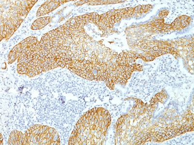 Formalin-fixed, paraffin-embedded Human Skin stained with Desmoglein-3 Monoclonal Antibody (DSG3/1535).