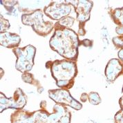 Formalin-fixed, paraffin-embedded human Placenta stained with Thymidine Phosphorylase / PD-ECGF Monoclonal Antibody (SPM322).
