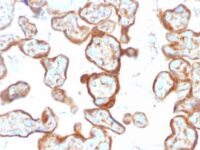 Formalin-fixed, paraffin-embedded human Placenta stained with Thymidine Phosphorylase / PD-ECGF Monoclonal Antibody (SPM322).