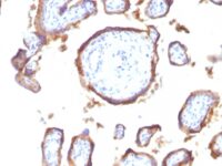 Formalin-fixed, paraffin-embedded human Placenta stained with EGFR Monoclonal Antibody (GFR1195).