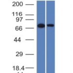 Western Blot of HeLa and A431 Cell Lysates with endoglin / CD15 Monoclonal Antibody (ENG/1327).