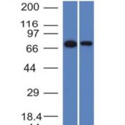 Western Blot of HeLa and A431 Cell Lysates with endoglin / CD15 Monoclonal Antibody (ENG/1327).