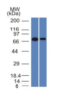 Western Blot of HeLa and A431 Cell Lysates with endoglin / CD15 Monoclonal Antibody (ENG/1327).