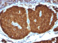 Formalin-fixed, paraffin-embedded Human Cerebellum stained with NSE gamma Monoclonal Antibody (ENO2/1375).