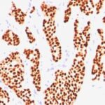 Western Blot of Estrogen Receptor in MCF-7 Lysate using Estrogen Receptor Ab (SPM567).