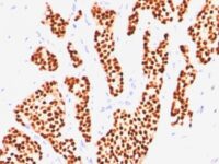 Western Blot of Estrogen Receptor in MCF-7 Lysate using Estrogen Receptor Ab (SPM567).