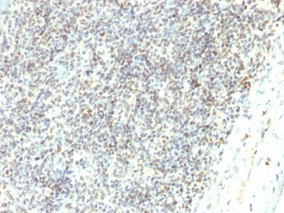 Formalin-fixed, paraffin-embedded human Spleen stained with ETS1 Monoclonal Antibody (ETS1/1282).