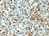 Western Blot Analysis of Recombinant Protein and HeLa Cell Lysate using Factor XIIIa Monoclonal Antibody (F13A1/1448).