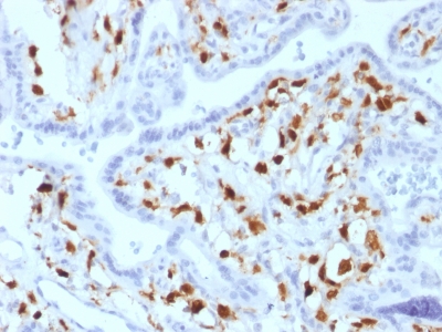 Formalin-fixed, paraffin-embedded human Placenta stained with Factor XIIIa Mouse Monoclonal Antibody (SPM18).