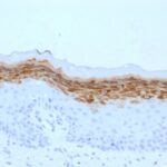 Formalin-fixed, paraffin-embedded human Skin stained with Filaggrin Monoclonal Antibody (FLG/1561).