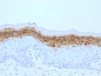 Formalin-fixed, paraffin-embedded human Skin stained with Filaggrin Monoclonal Antibody (FLG/1561).