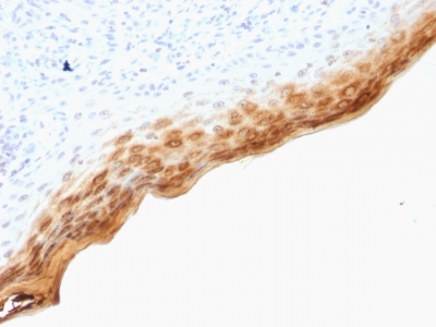 Formalin-fixed, paraffin-embedded human Skin stained with Filaggrin Monoclonal Antibody (SPM181).