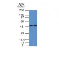 Western Blot of THP1 and Raji Cell Lysate using FLI1 Monoclonal Antibody (FLI1/1312)