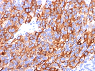 Formalin-fixed, paraffin-embedded human Testis stained with MART-1 / Melan-A Monoclonal Antibody (A13 + M2-7C1 + M2-9E3).