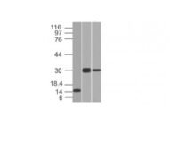 Western Blot of Recombinant, Panc-28 and PANC1 Cell Lysates Using CELA3B MAb (CELA3B/1218).