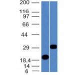 Western Blot Analysis of Recombinant Protein and Human Pancreas Lysates using CELA3B Monoclonal Antibody (CELA3B/1811)