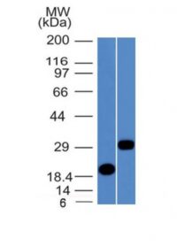 Western Blot Analysis of Recombinant Protein and Human Pancreas Lysates using CELA3B Monoclonal Antibody (CELA3B/1811)