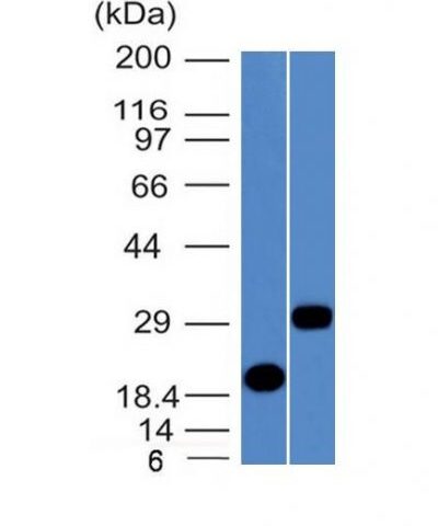 Western Blot Analysis of Recombinant Protein and Human Pancreas Lysates using CELA3B Monoclonal Antibody (CELA3B/1811)