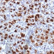 Formalin-fixed, paraffin-embedded Human Pancreas stained with CELA3B Monoclonal Antibody (CELA3B/1757)