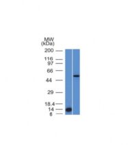 Western Blot Analysis (A) Recombinant Protein (B) HepG2 Cell lysate Using ALK-1 Monoclonal Antibody (ALK/153).