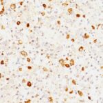 Formalin-fixed, paraffin-embedded human Pituitary stained with FSH-beta Monoclonal Antibody (FSHb/162).