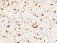 Formalin-fixed, paraffin-embedded human Pituitary stained with FSH-beta Monoclonal Antibody (FSHb/162).