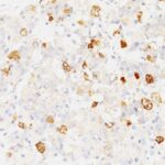 Formalin-fixed, paraffin-embedded human Pituitary stained with FSH-beta Monoclonal Antibody (SPM17).