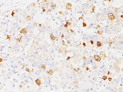 Formalin-fixed, paraffin-embedded human Pituitary stained with FSH-beta Monoclonal Antibody (SPM17).