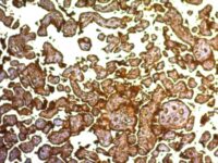 Formalin-fixed, paraffin-embedded human Placenta stained with PLAP Monoclonal Antibody (SPM593).