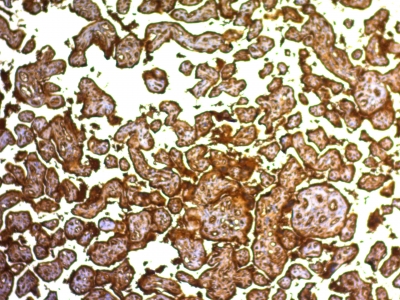 Formalin-fixed, paraffin-embedded human Placenta stained with PLAP Monoclonal Antibody (SPM593).
