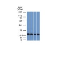 Formalin-fixed, paraffin-embedded Human Pancreas stained with Ferritin, Light Chain Monoclonal Antibody (FTL/1386).