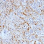 Formalin-fixed, paraffin-embedded Human Pancreas stained with Ferritin, Light Chain Monoclonal Antibody (FTL/1388).