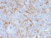 Formalin-fixed, paraffin-embedded Human Pancreas stained with Ferritin, Light Chain Monoclonal Antibody (FTL/1388).