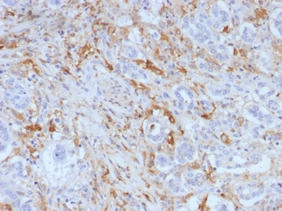 Formalin-fixed, paraffin-embedded Human Pancreas stained with Ferritin, Light Chain Monoclonal Antibody (FTL/1388).