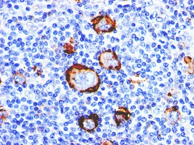 FACS analysis of human Monocytes using CD15 Monoclonal Antibody (Leu-M1).