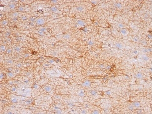 Western Blot of human Cerebellum Lysate using GFAP Monoclonal Antibody (GA-5).