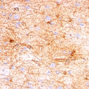 Formalin-fixed, paraffin-embedded human Cerebellum stained with GFAP Monoclonal Antibody (SPM57).