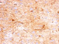 Formalin-fixed, paraffin-embedded human Cerebellum stained with GFAP Monoclonal Antibody (SPM57).