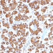 Formalin-fixed, paraffin-embedded Human Pituitary stained with Growth Hormone Monoclonal Antibody (GH/145).