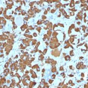 Formalin-fixed, paraffin-embedded Human Pituitary stained with Growth Hormone Monoclonal Antibody (SPM16).