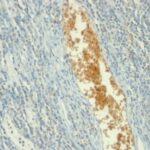 Formalin-fixed, paraffin-embedded human Placenta stained with AMPD3 Monoclonal Antibody (AMPD3/91)